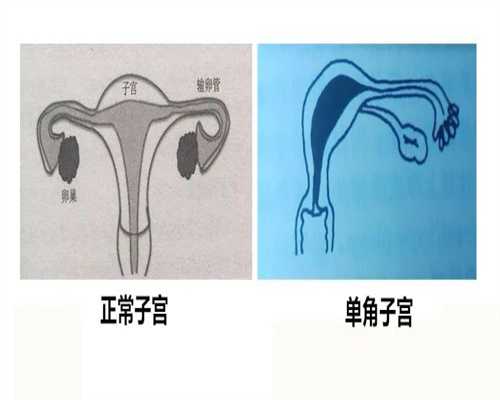 男人不结婚可以试管吗,哪些人适合在广州做第三代试管婴儿？适应症全解析