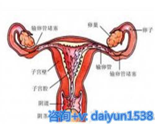国内哪里可以借卵生子,试管婴儿的自然周期方案卵泡取出要打破卵针吗？